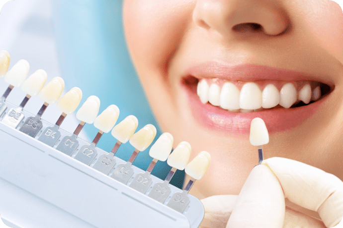 歯を見せている口元で歯の色のサンプルを合わせて見比べている写真