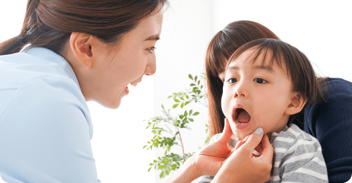 女性に抱っこされている子供のお口を歯科衛生士が診ている様子